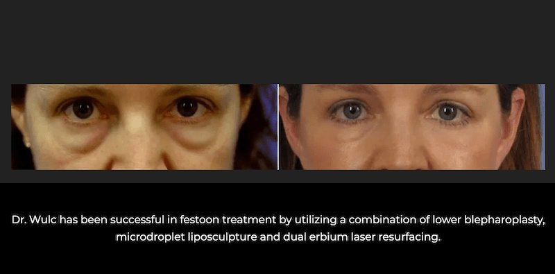patient results