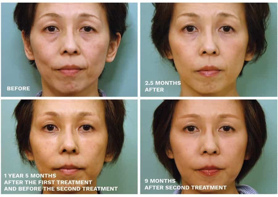 patient results